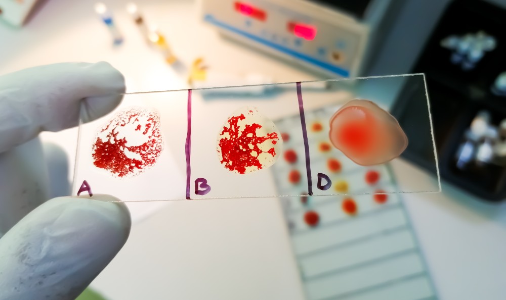 Poradnia hematologiczna łęczna